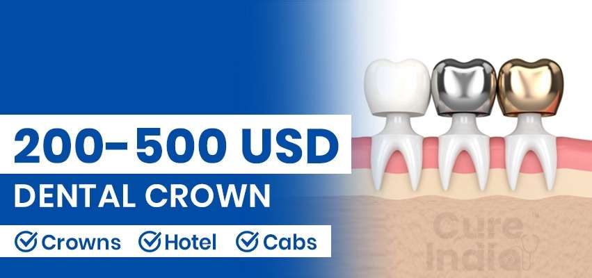 Cost of Dental Crown